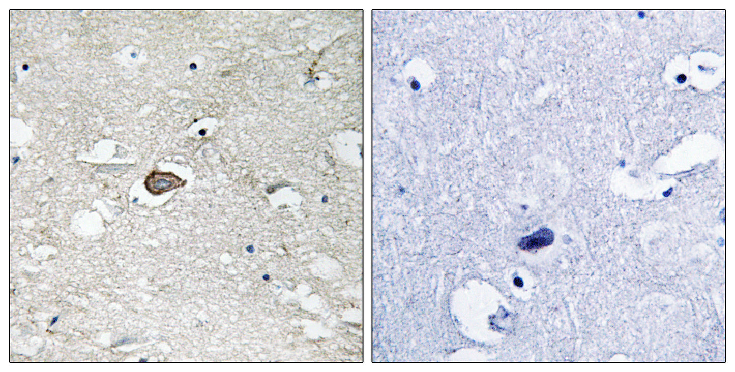 Trk A Rabbit Polyclonal Antibody