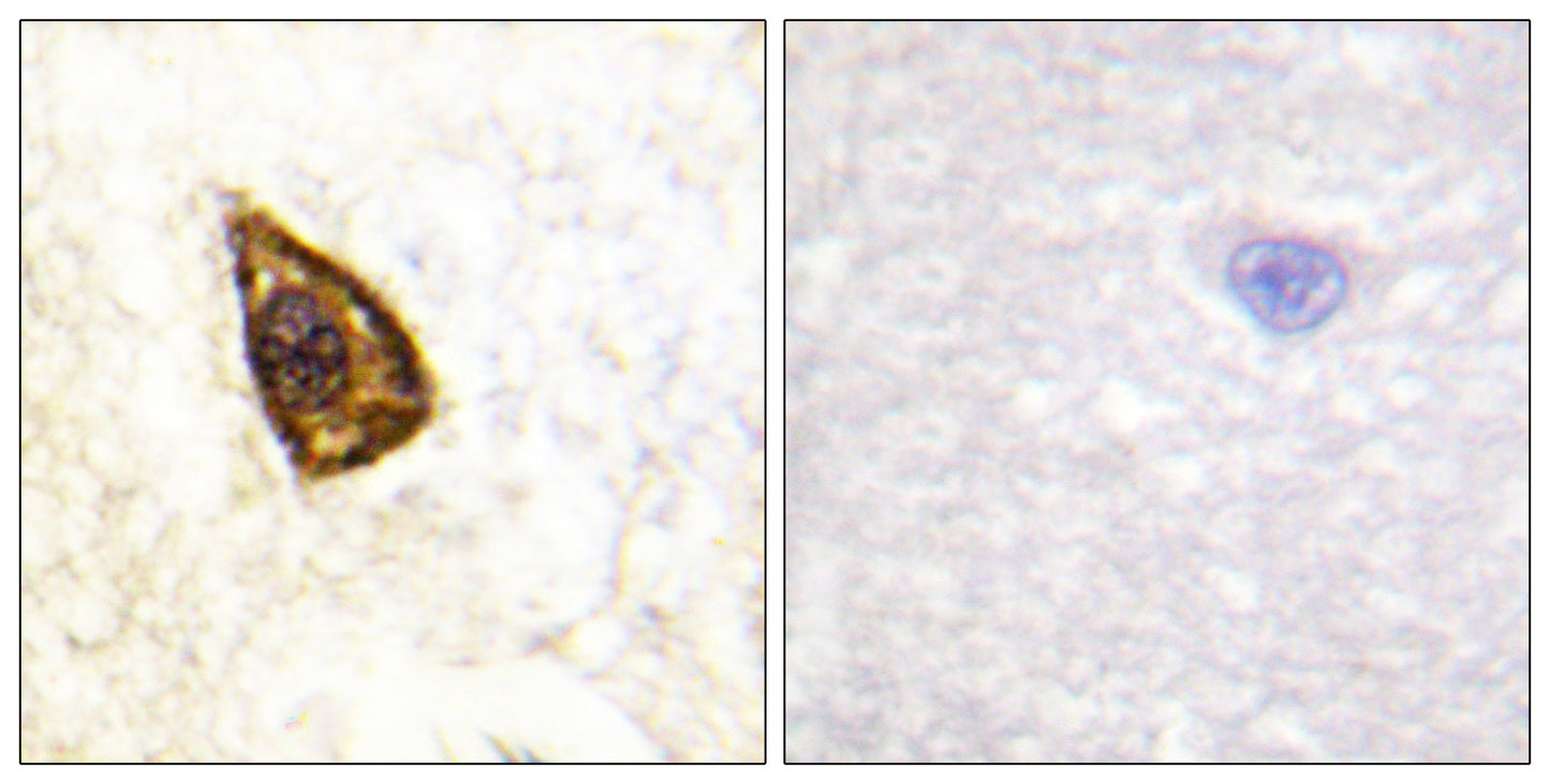 Trk B Rabbit Polyclonal Antibody