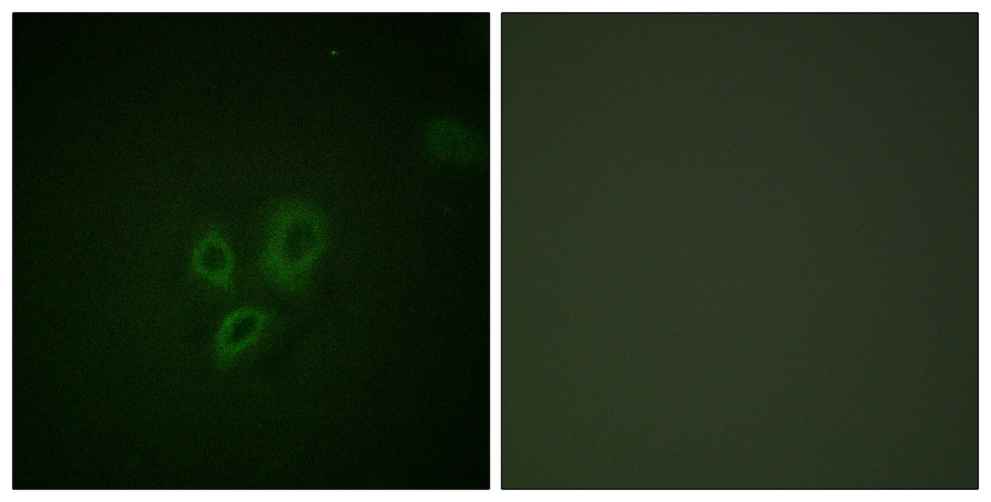 Troponin I-C Rabbit Polyclonal Antibody
