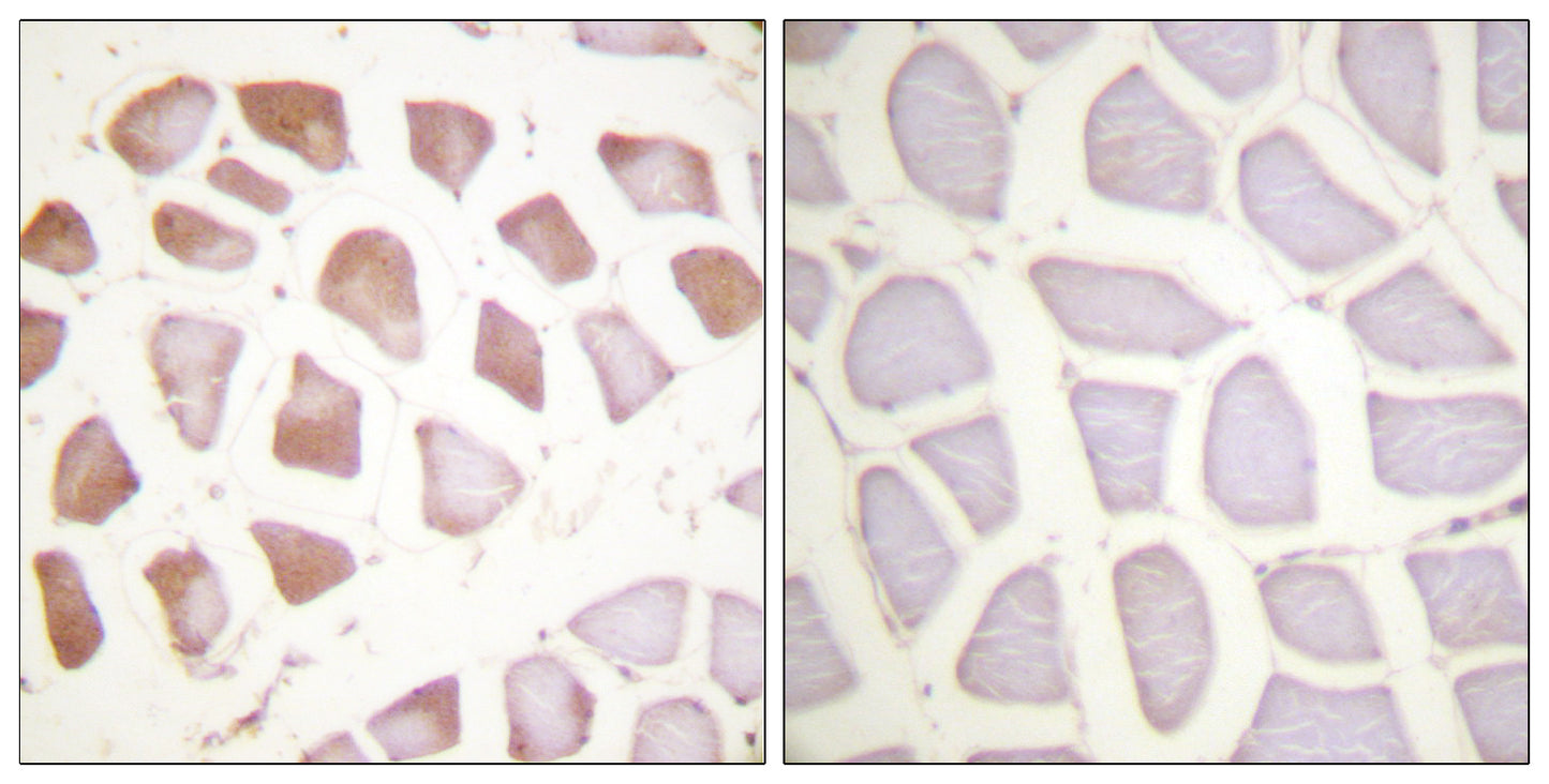 Troponin I-C Rabbit Polyclonal Antibody