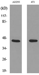 Troponin T-C Rabbit Polyclonal Antibody