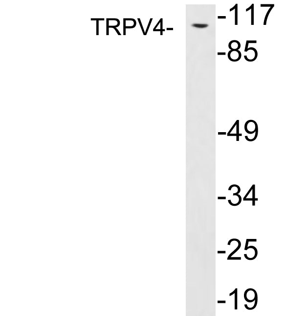 TRPV4 Rabbit Polyclonal Antibody