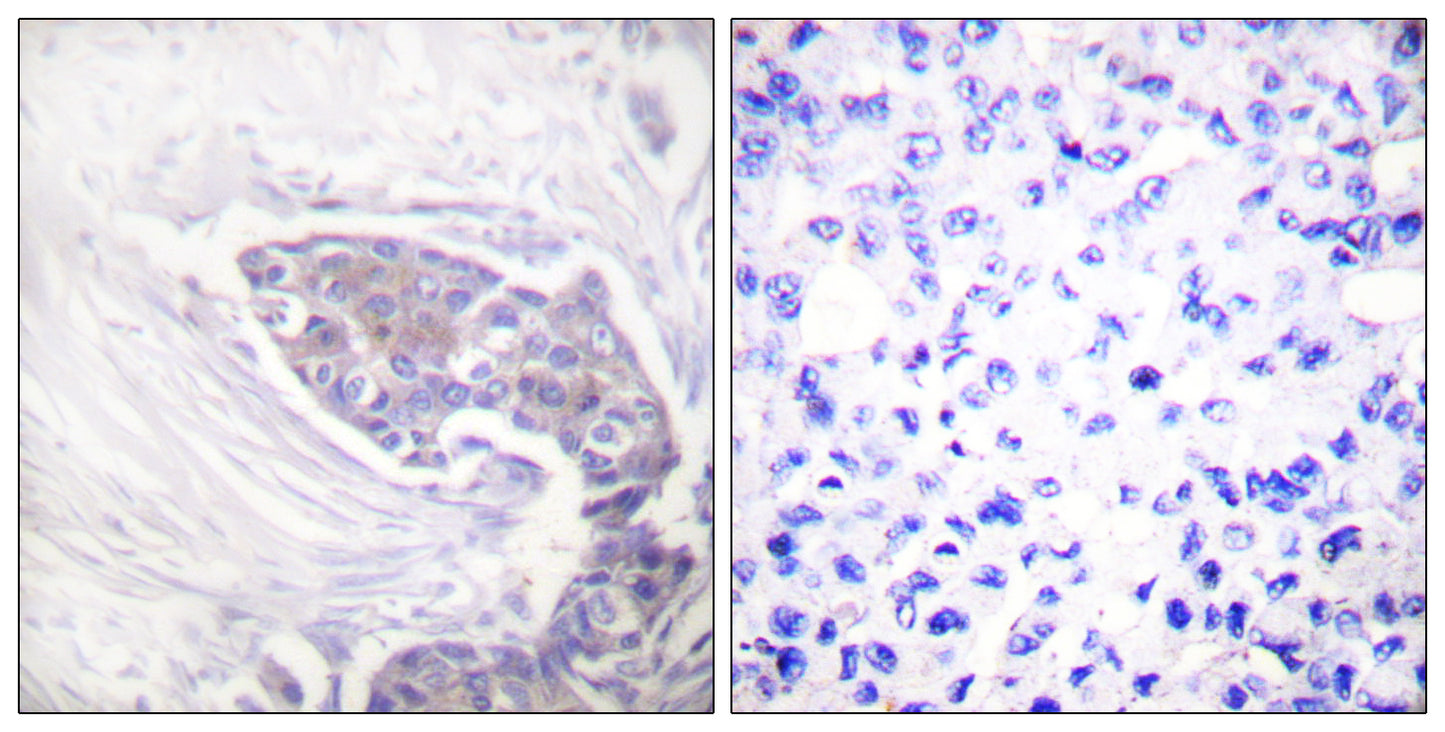 TrxR2 Rabbit Polyclonal Antibody