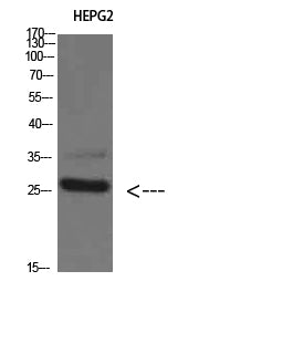 Tryptase-3 Rabbit Polyclonal Antibody