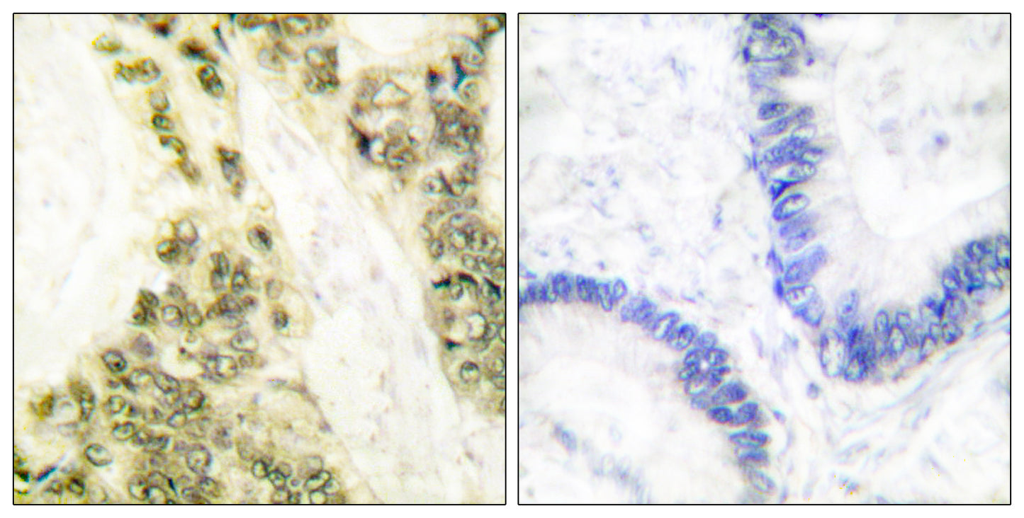 TRα Rabbit Polyclonal Antibody