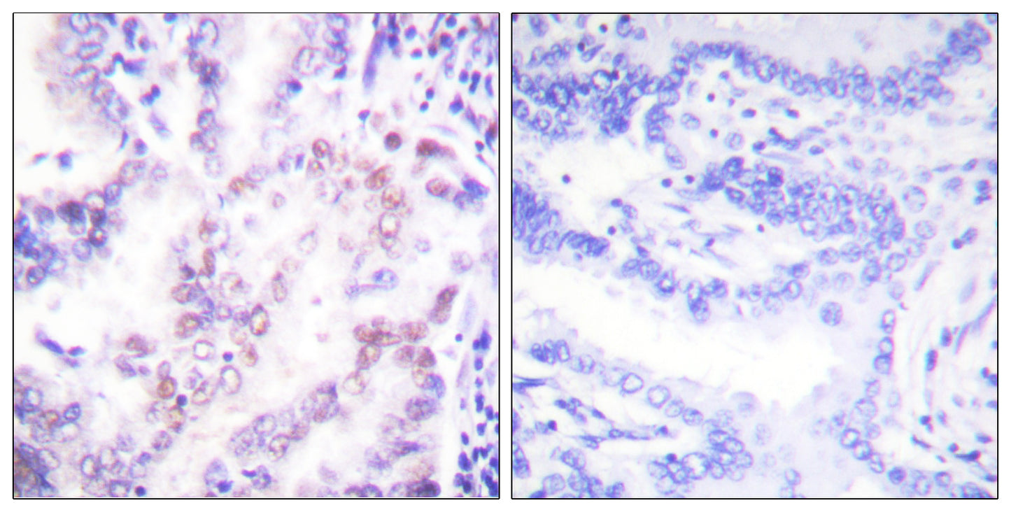 TRβ1 Rabbit Polyclonal Antibody