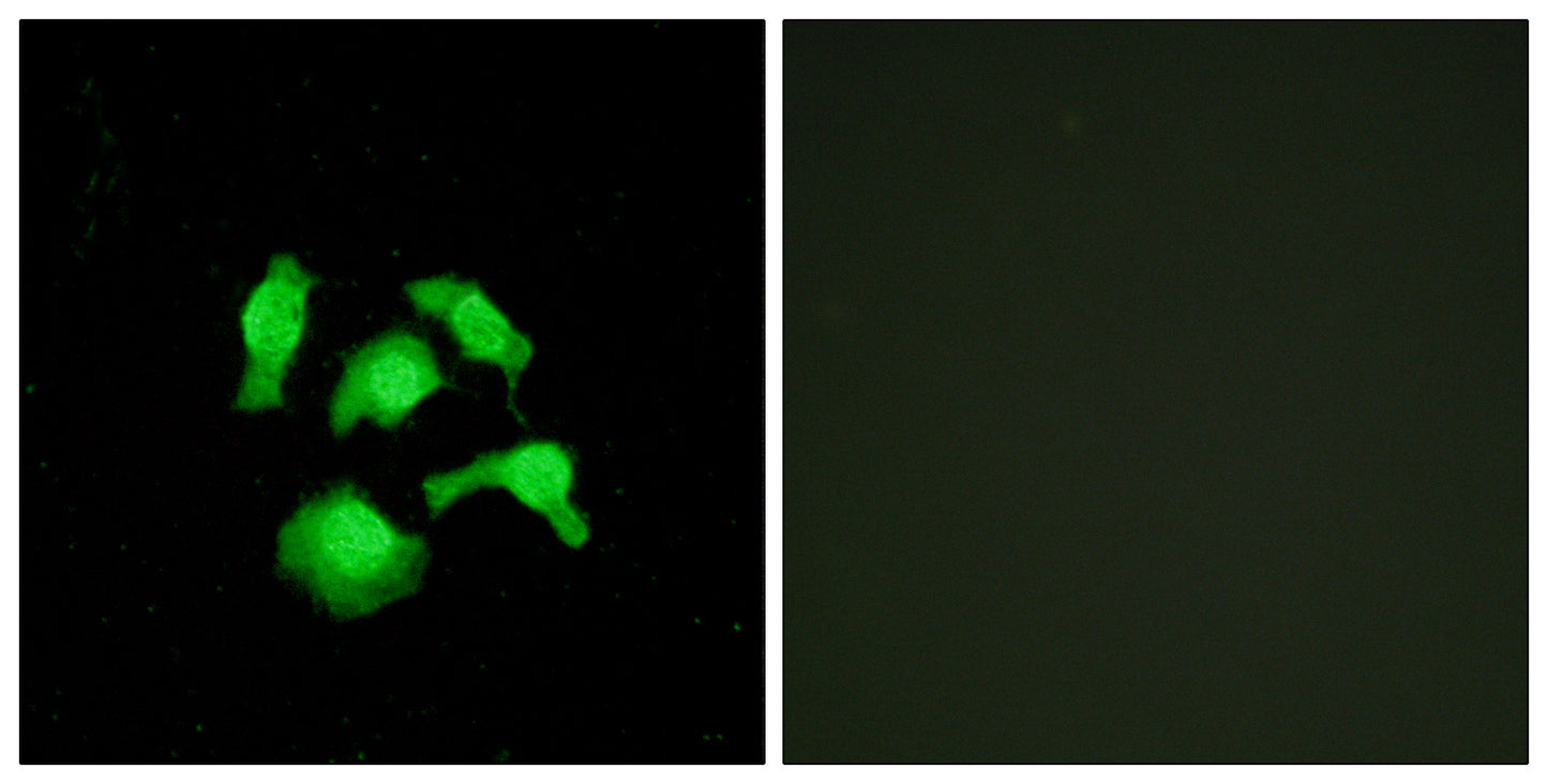 TSC-22 Rabbit Polyclonal Antibody