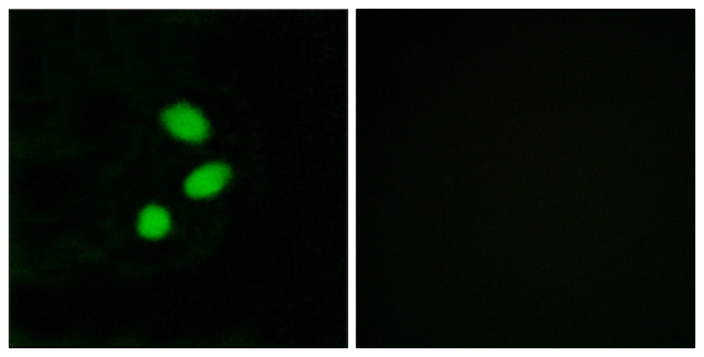 TSHZ2 Rabbit Polyclonal Antibody