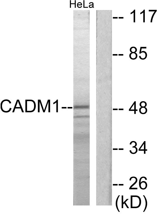 TSLC1 Rabbit Polyclonal Antibody