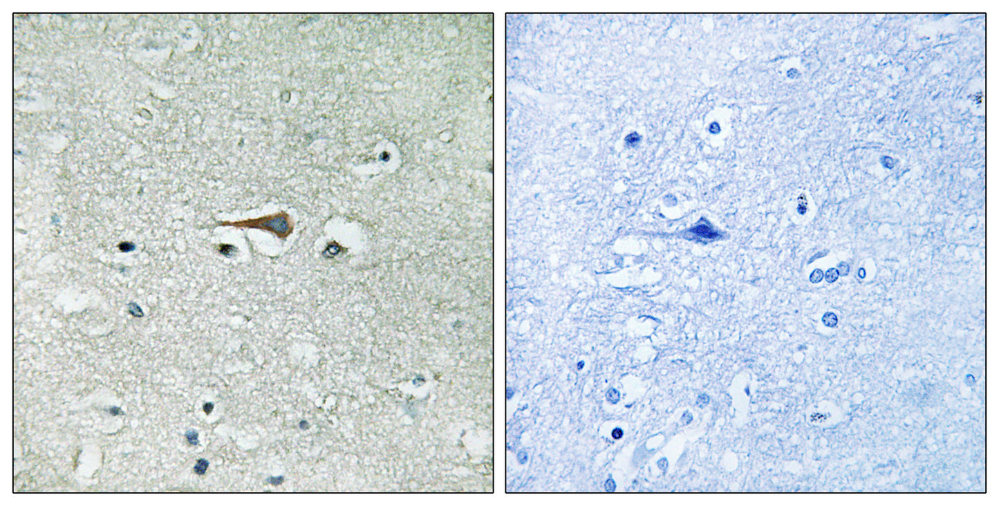 TTK Rabbit Polyclonal Antibody