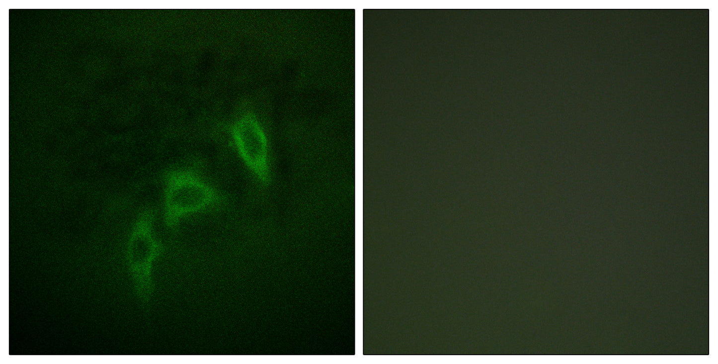 Tuberin Rabbit Polyclonal Antibody