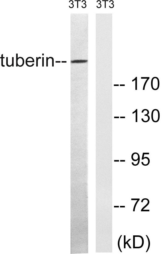 Tuberin Rabbit Polyclonal Antibody