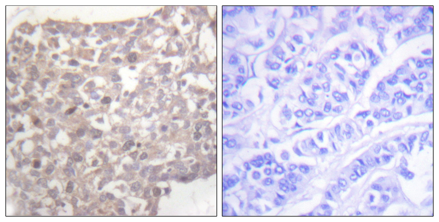 Tubulin γ Rabbit Polyclonal Antibody