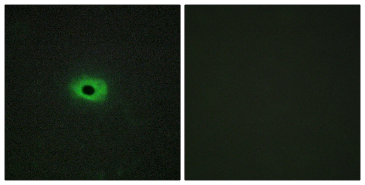 TWEAK Rabbit Polyclonal Antibody