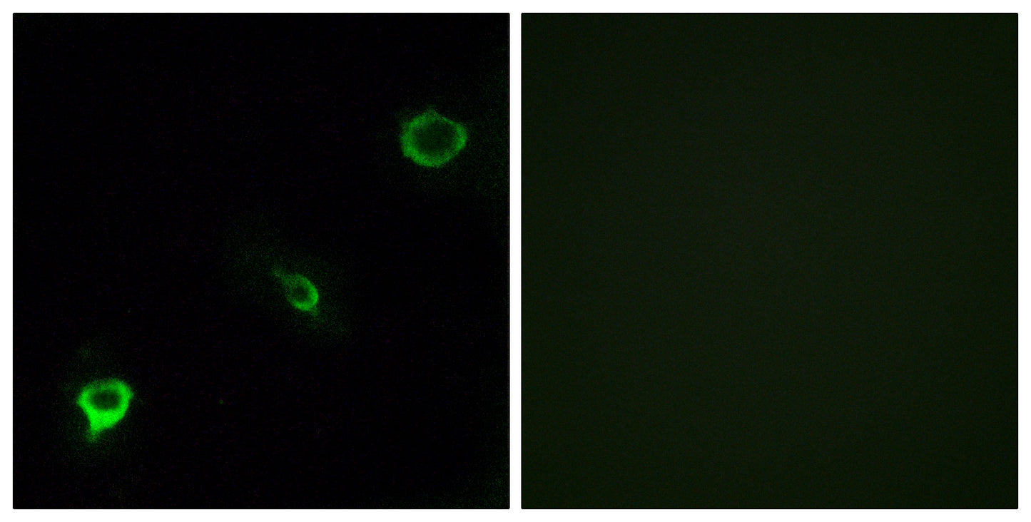 Tyk 2 Rabbit Polyclonal Antibody