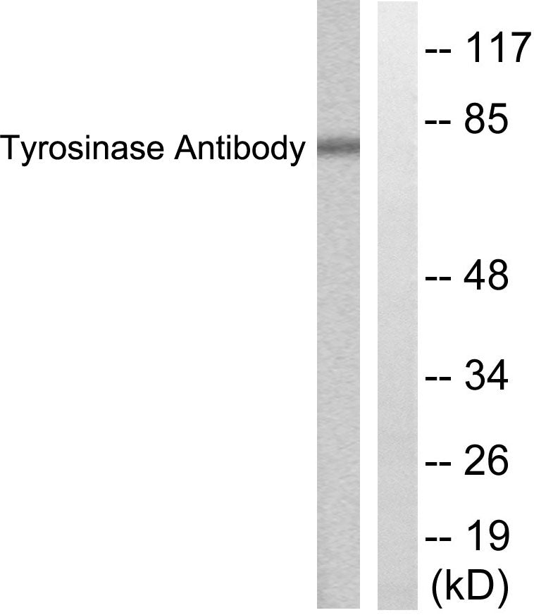 TYR Rabbit Polyclonal Antibody