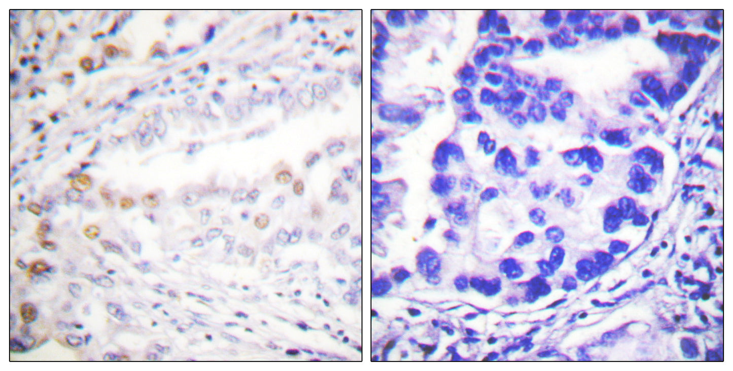 UBA2 Rabbit Polyclonal Antibody