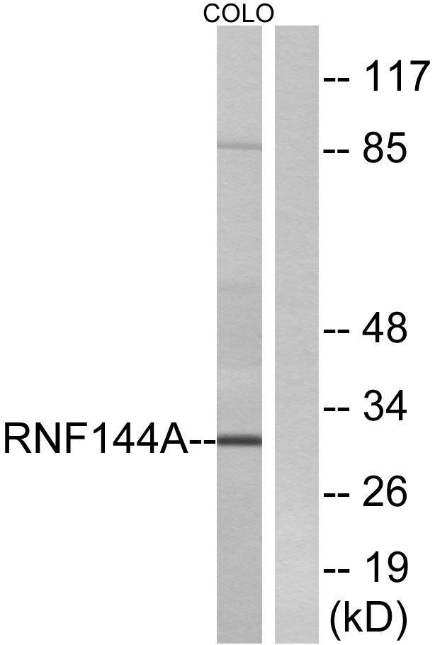 UBCE7IP4 Rabbit Polyclonal Antibody