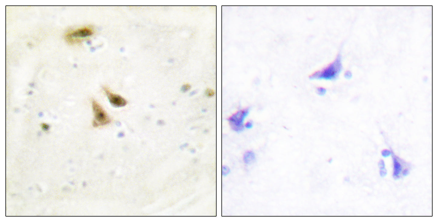 UBF-1 Rabbit Polyclonal Antibody
