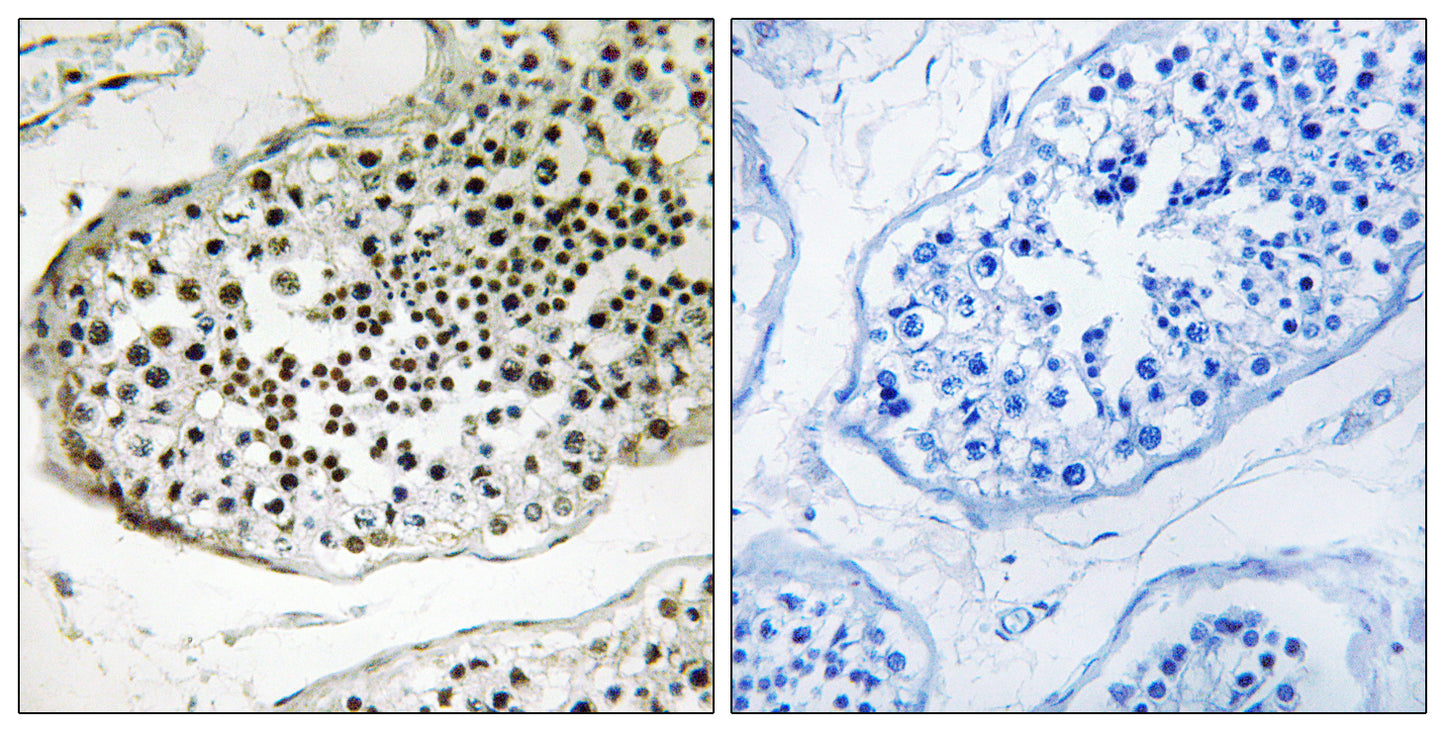 Ubiquilin-3 Rabbit Polyclonal Antibody