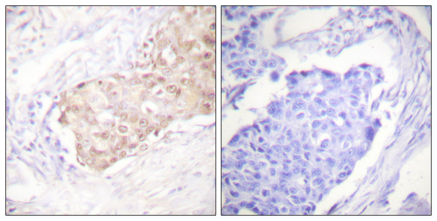 UBR5 Rabbit Polyclonal Antibody