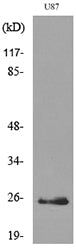 UCH-L1 Rabbit Polyclonal Antibody