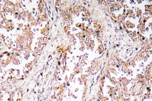 UCP2 Rabbit Polyclonal Antibody
