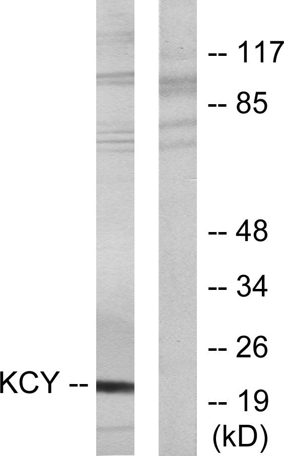 UMP-CMP Kinase Rabbit Polyclonal Antibody