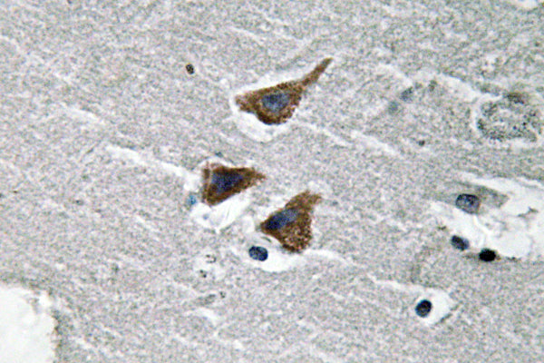 uPA Rabbit Polyclonal Antibody