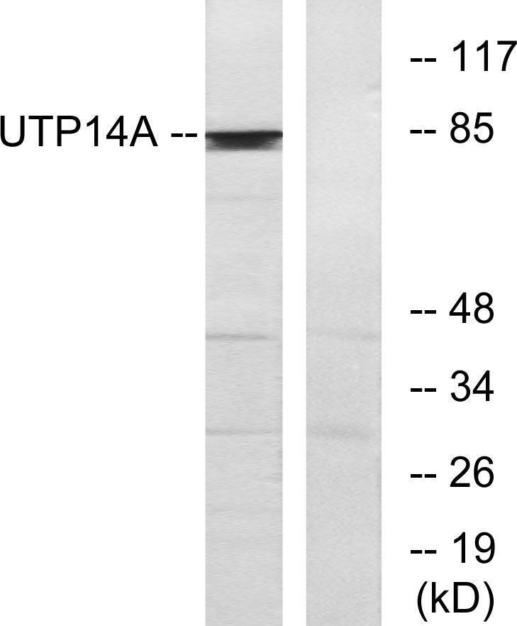 UTP14A Rabbit Polyclonal Antibody