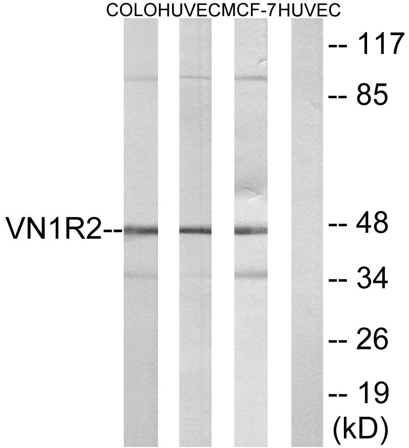 V1RL2 Rabbit Polyclonal Antibody