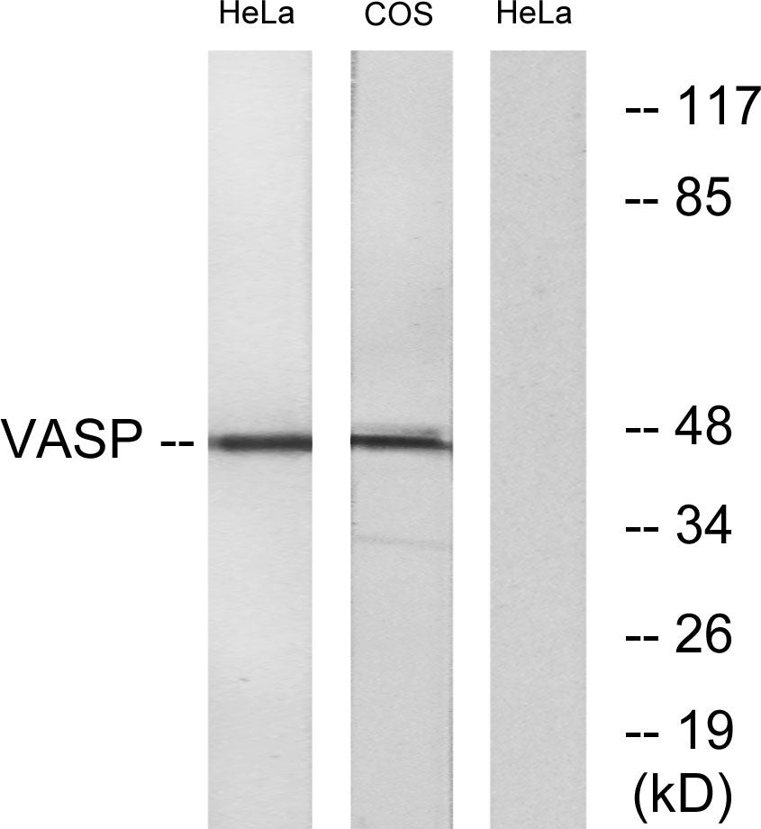 VASP Rabbit Polyclonal Antibody