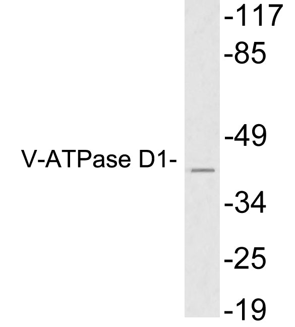V-ATPase D1 Rabbit Polyclonal Antibody