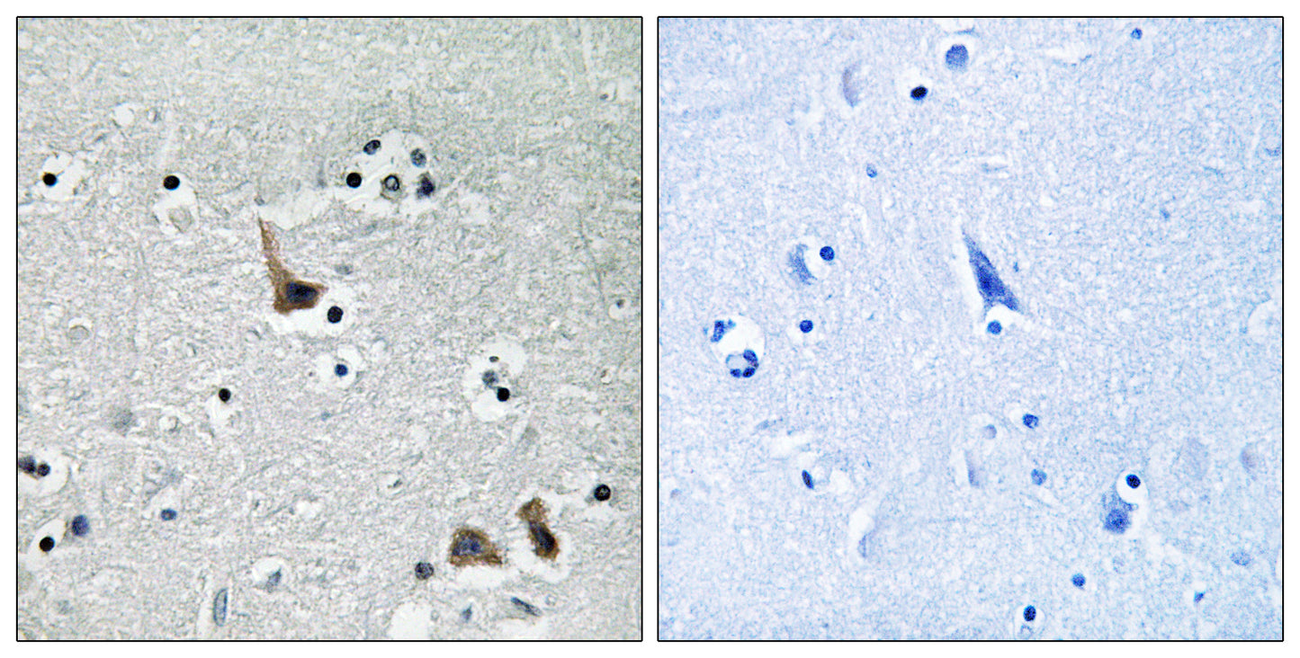 V-ATPase H Rabbit Polyclonal Antibody
