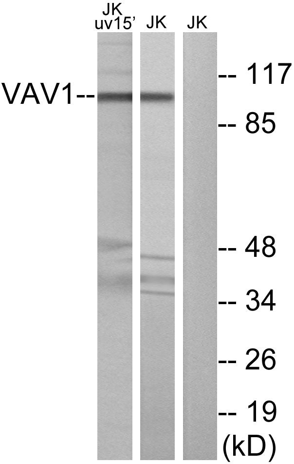 Vav1 Rabbit Polyclonal Antibody