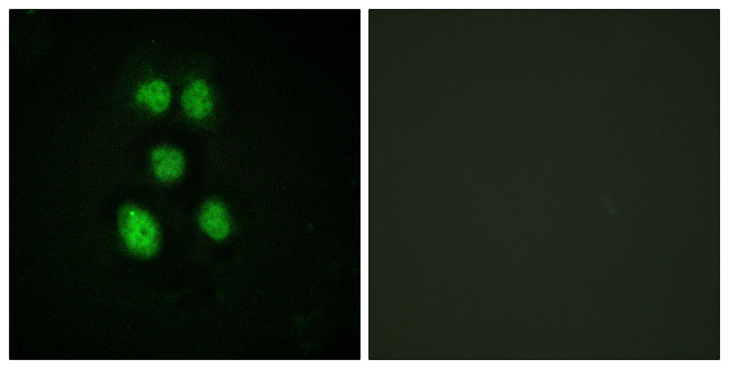 VAV1 Rabbit Polyclonal Antibody