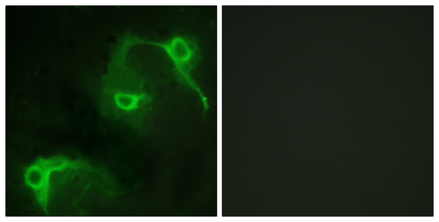 Vav2 Rabbit Polyclonal Antibody
