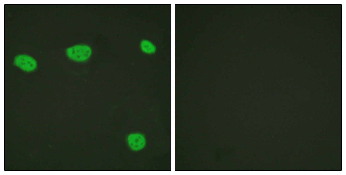 VDR Rabbit Polyclonal Antibody