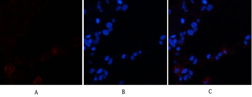 VE-Cadherin Rabbit Polyclonal Antibody
