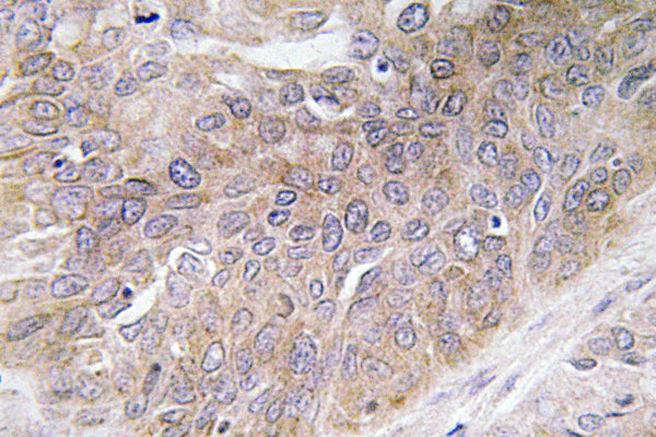 VEGF-D Rabbit Polyclonal Antibody