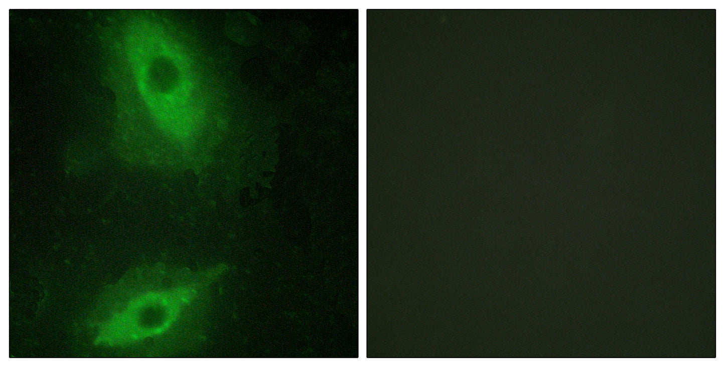 VEGI Rabbit Polyclonal Antibody