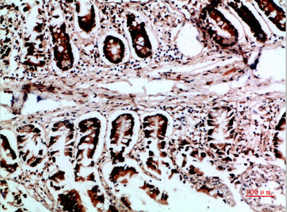 VHL Rabbit Polyclonal Antibody