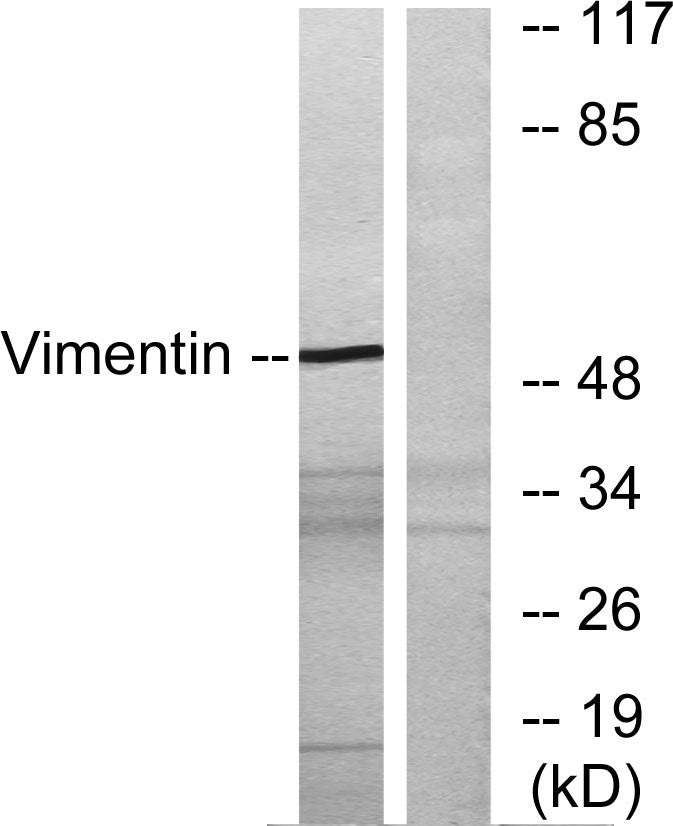 Vimentin Rabbit Polyclonal Antibody