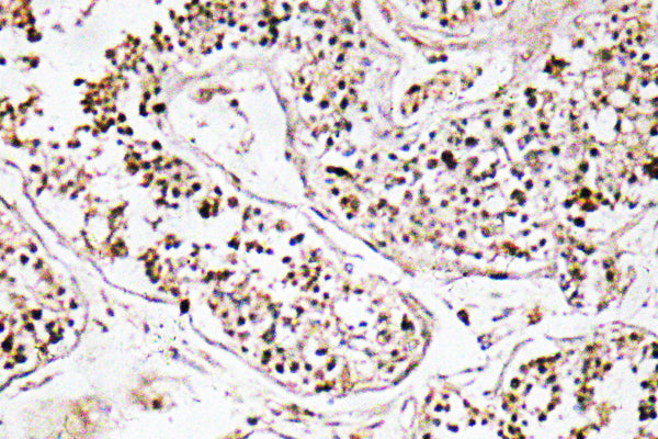 VIP Rabbit Polyclonal Antibody