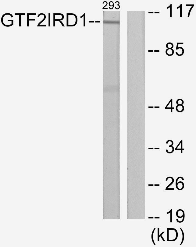 WBSCR11 Rabbit Polyclonal Antibody