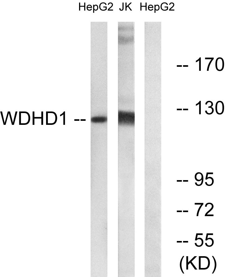 WDHD1 Rabbit Polyclonal Antibody