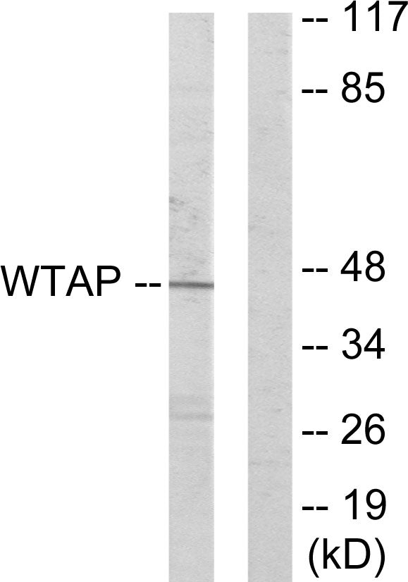 WTAP Rabbit Polyclonal Antibody