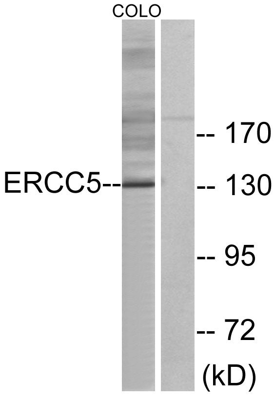 XPG Rabbit Polyclonal Antibody