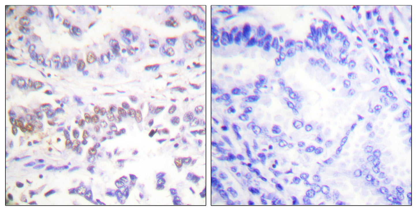 XRCC3 Rabbit Polyclonal Antibody