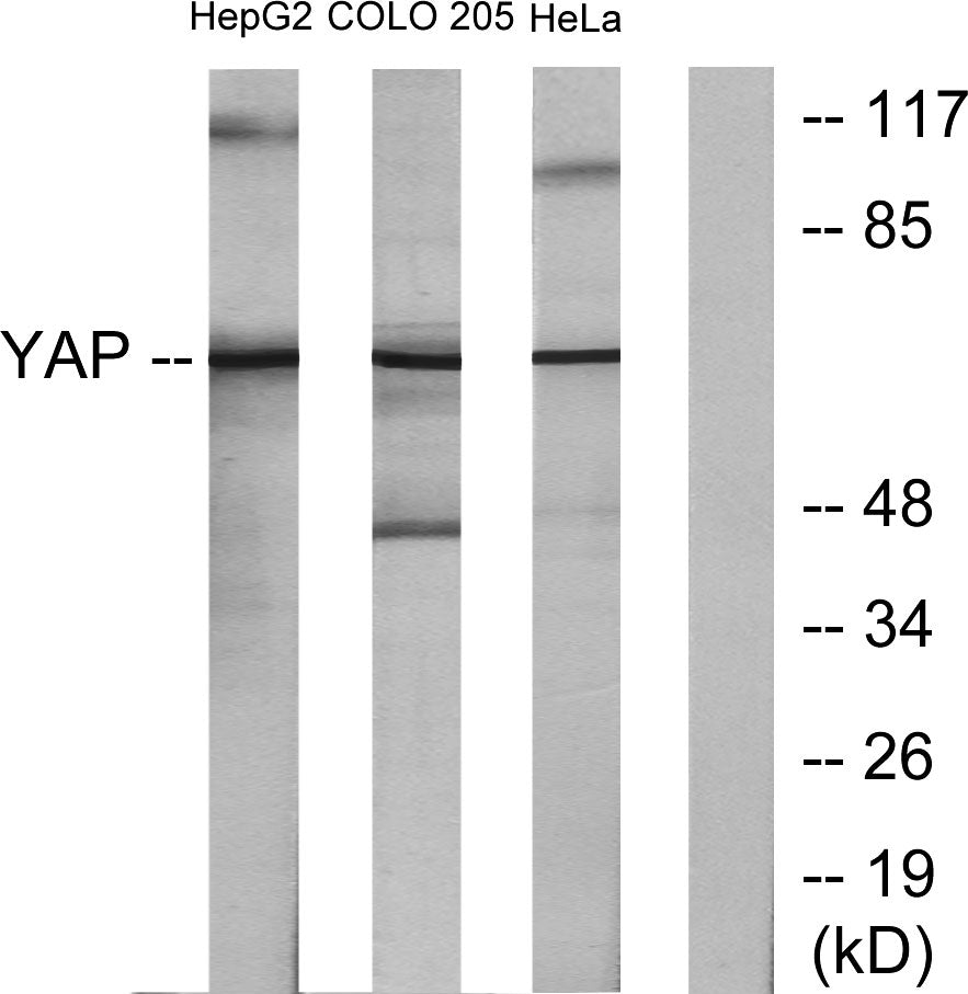YAP Rabbit Polyclonal Antibody
